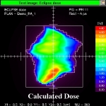 artemis-calculated-dose