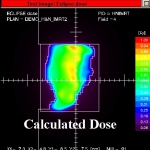 hera-calculated-dose